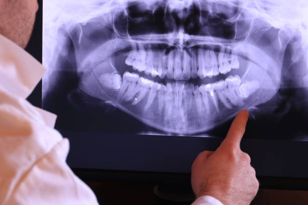 Best Emergency Broken Tooth Repair in Centerville, IA