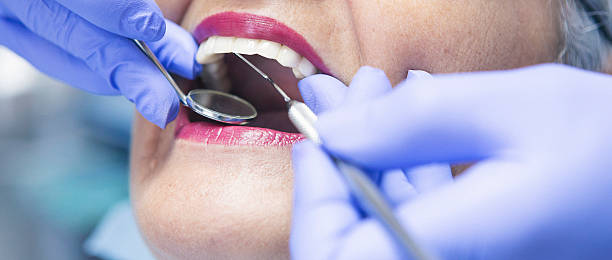 Best Emergency Treatment for Toothache in Centerville, IA